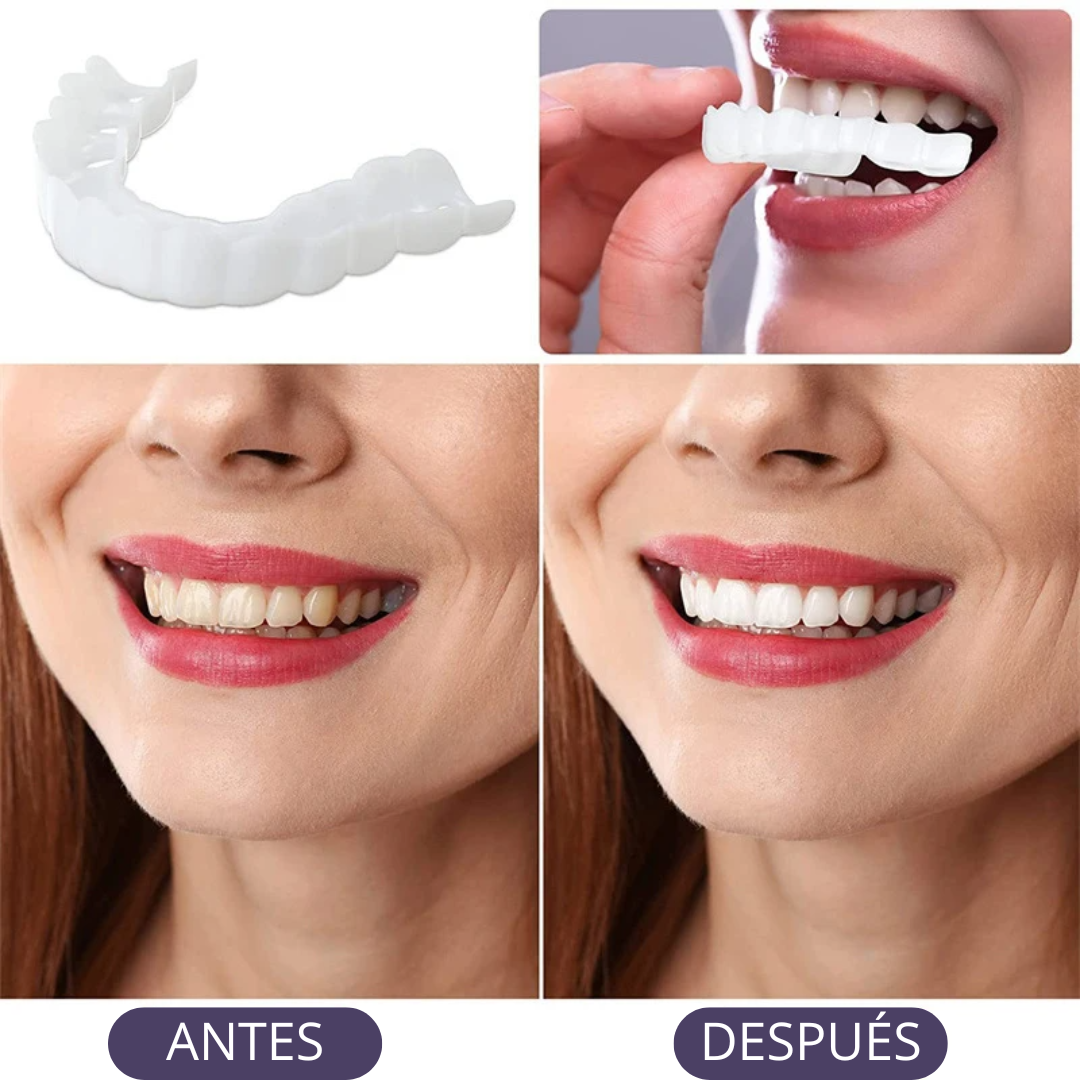 Kit 3 x 1 Carillas Dentales Adaptables | Transforma tu Sonrisa   🔥 Regalo ¡Solo hoy! 1 Carillas Gratis